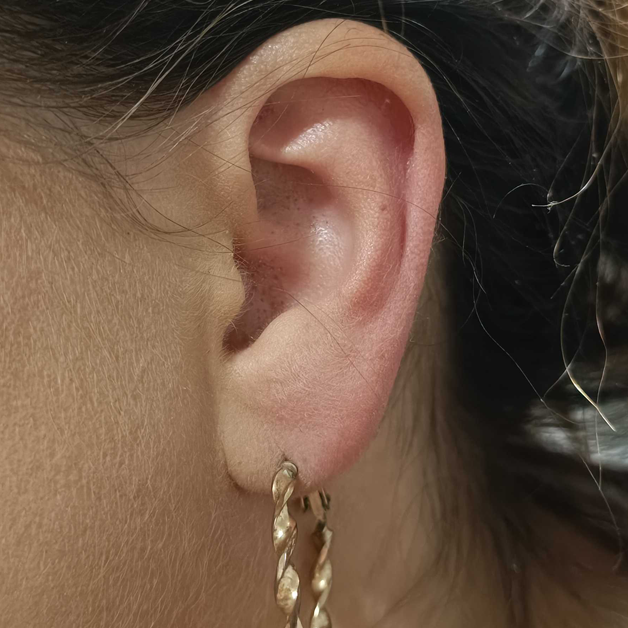 Wenn die Ohren jucken: 5 hilfreiche Hausmittel. Detailansicht eines Ohrs mit Ohrschmuck
